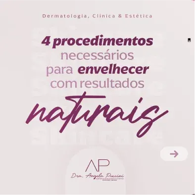 Postagens: aplicação 29 do projeto